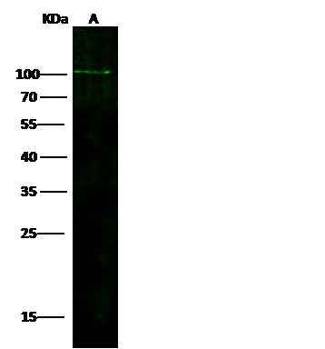 Anti-Human ADAM12 Antibody [A1220] - ABMIUM