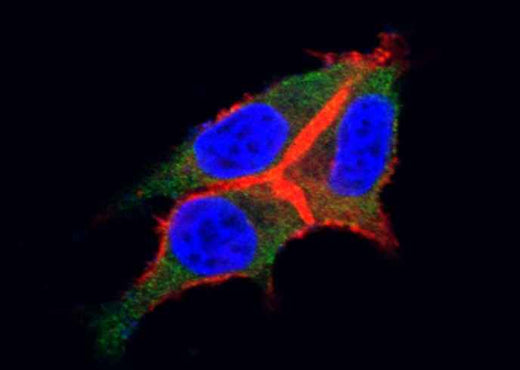 Anti-Human CSF3R Antibody [A1023] - ABMIUM