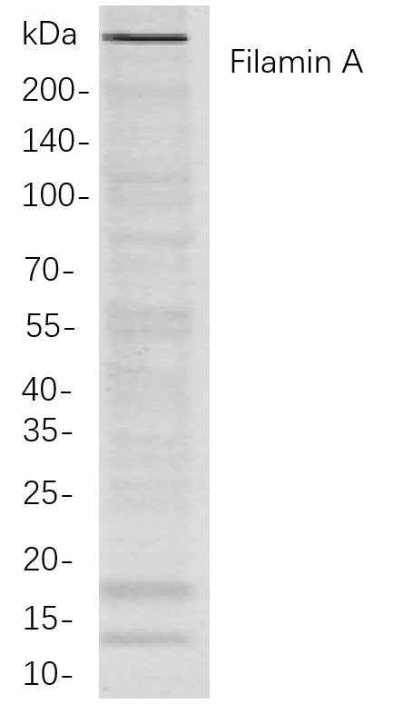 Anti-Human/Mouse/Rat Filamin A Antibody [B704] - ABMIUM