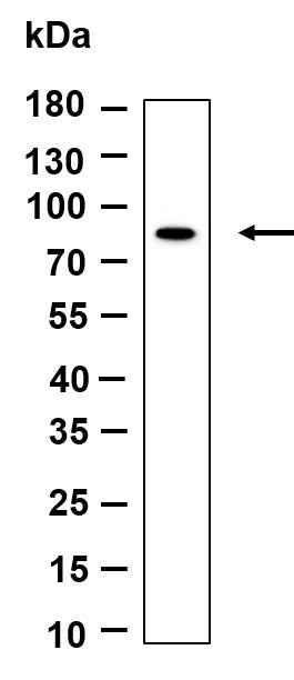 Anti-Human/Mouse/Rat TBK1 Antibody [B896] - ABMIUM