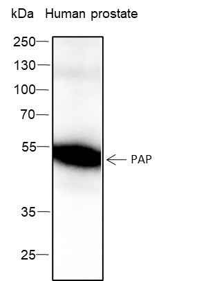 Anti-Human PAP Antibody [A322] - ABMIUM