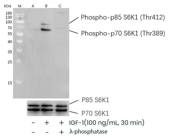 Anti-Human RPS6KB1 Antibody [B285] - ABMIUM