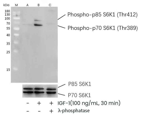 Anti-Human RPS6KB1 Antibody [B285] - ABMIUM