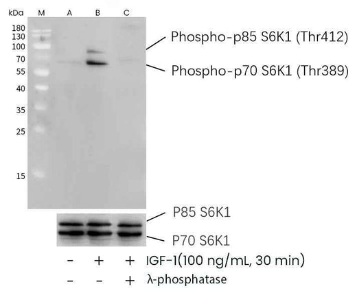 Anti-Human RPS6KB1 Antibody [B285] - ABMIUM