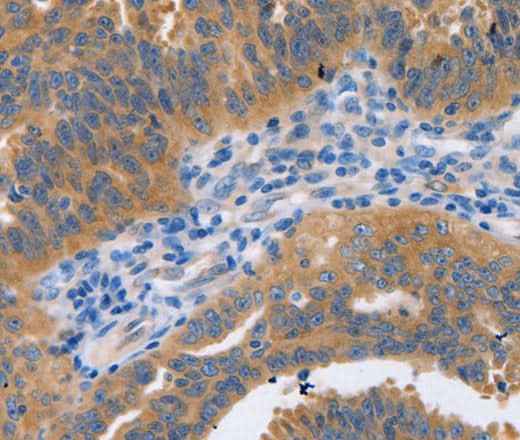 Anti-Human/Mouse NBEA Antibody