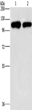 Anti-Human/Mouse/Rat PIP5K1C Antibody - ABMIUM