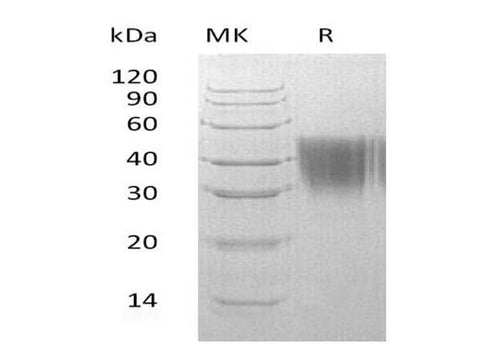 SDS-PAGE analysis of Human ORM2 proteins, 2 μg/lane of Recombinant Human ORM2 proteins was resolved with SDS-PAGE under reducing conditions, showing bands at 36 kDa.