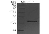 Recombinant Human Placental Lactogen/CSH1 Protein (His Tag) - ABMIUM
