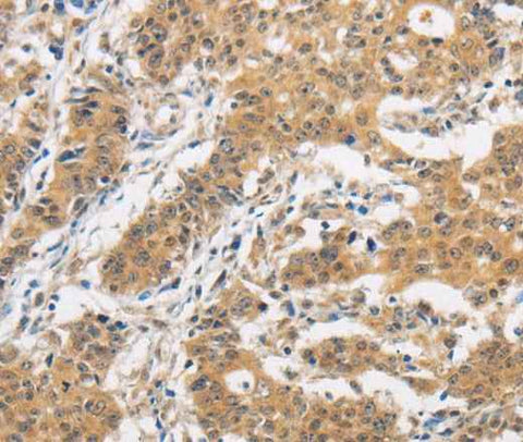 Anti-Human ITGB3BP Antibody
