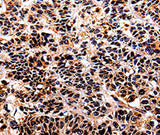 Anti-Human IL10RA Antibody - ABMIUM