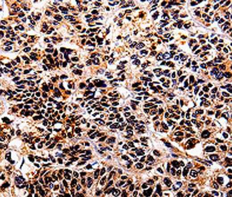Anti-Human IL10RA Antibody