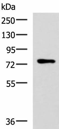 Western blot analysis of Mouse thymus tissue lysate using L3MBTL2 Polyclonal Antibody at dilution of 1:800
