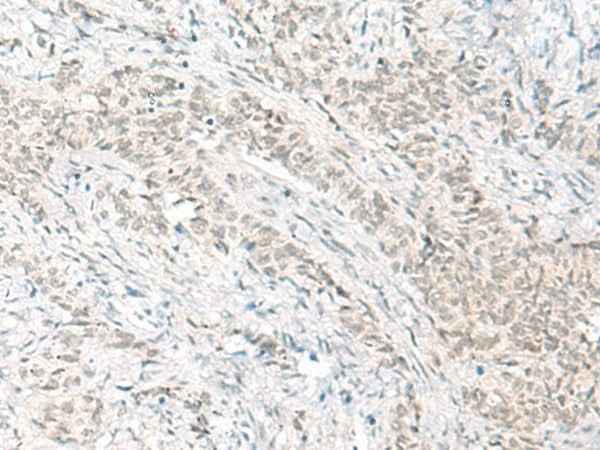 Anti-Human/Mouse/Rat HABP4 Antibody