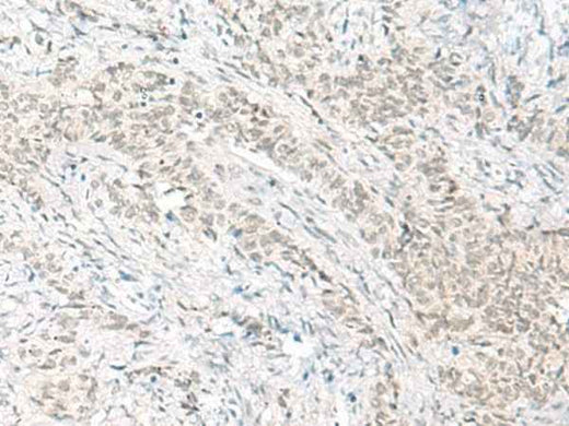 Anti-Human/Mouse/Rat HABP4 Antibody