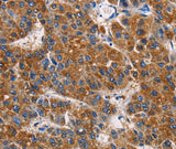 Anti-Human/Mouse/Rat APLNR Antibody - ABMIUM