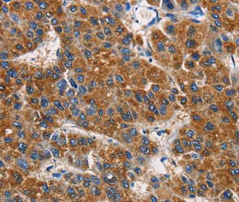 Anti-Human/Mouse/Rat APLNR Antibody