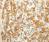 Anti-Human/Mouse ERG Antibody - ABMIUM