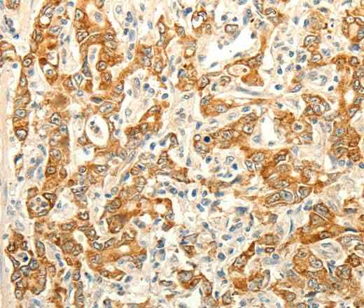 Anti-Human/Mouse ERG Antibody