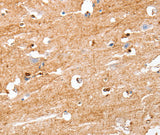 Anti-Human/Mouse/Rat S100B Antibody - ABMIUM