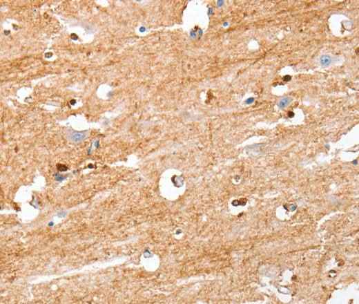 Anti-Human/Mouse/Rat S100B Antibody
