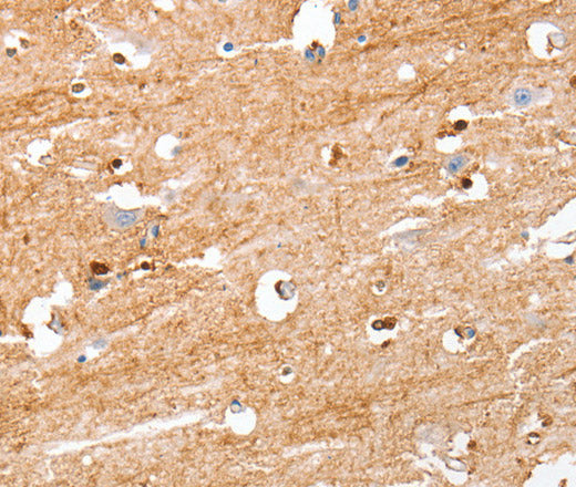 Anti-Human/Mouse/Rat S100B Antibody - ABMIUM