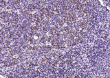 Anti-Human PDCD1 Antibody [B251]