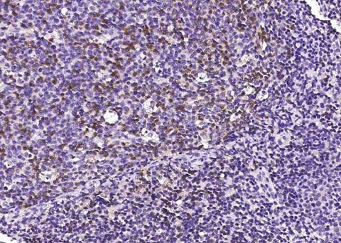Anti-Human PDCD1 Antibody [B251] - ABMIUM