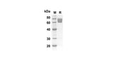 SDS-PAGE analysis of Mouse DCN proteins, 2 μg/lane of Recombinant Mouse DCN proteins was resolved with SDS-PAGE under reducing conditions, showing bands at 60.5 kDa.