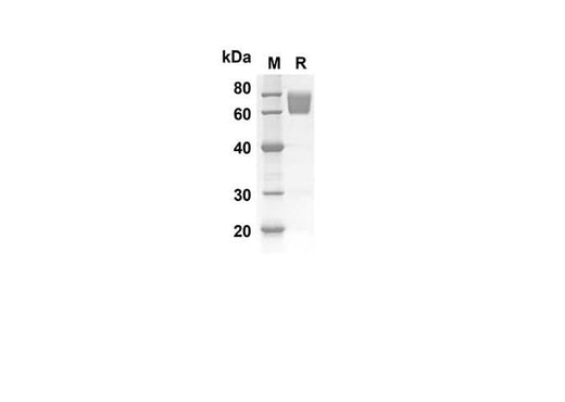 SDS-PAGE analysis of Mouse DCN proteins, 2 μg/lane of Recombinant Mouse DCN proteins was resolved with SDS-PAGE under reducing conditions, showing bands at 60.5 kDa.