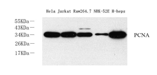 Western Blot analysis of various samples using Proliferating Cell Nuclear Antigen Polyclonal Antibody at dilution of 1:2000.