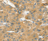 Anti-Human/Mouse/Rat SORT1 Antibody - ABMIUM