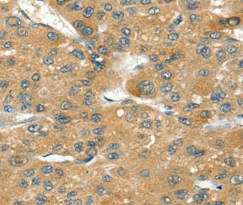 Anti-Human/Mouse/Rat SORT1 Antibody - ABMIUM