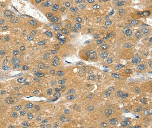 Anti-Human/Mouse/Rat SORT1 Antibody - ABMIUM