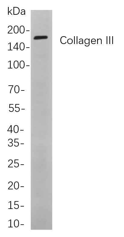 Anti-Human/Mouse/Rat Collagen III Antibody [B849] - ABMIUM
