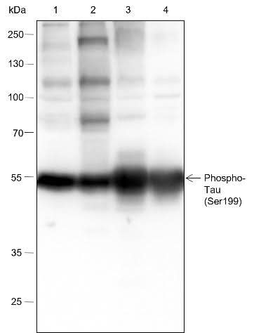 Anti-Human/Rat/Mouse Phospho-Tau (Ser199) Antibody [A803] - ABMIUM