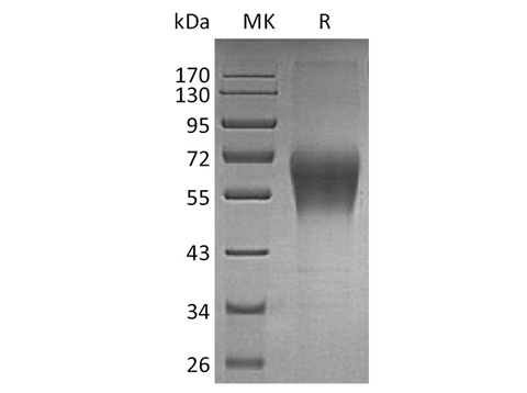Recombinant Human TRAIL R4/TNFRSF10D Protein (Fc Tag) - ABMIUM