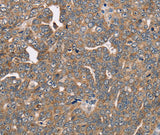 Anti-Human/Mouse/Rat FAIM2 Antibody - ABMIUM