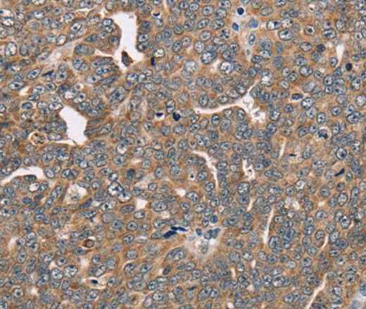 Anti-Human/Mouse/Rat FAIM2 Antibody
