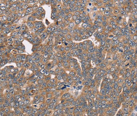 Anti-Human/Mouse/Rat FAIM2 Antibody - ABMIUM