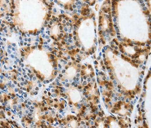 Anti-Human/Mouse/Rat SELENOS Antibody