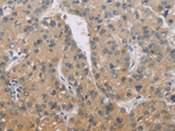 Anti-Human/Mouse ZBTB6 Antibody - ABMIUM