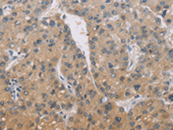 Anti-Human/Mouse ZBTB6 Antibody - ABMIUM