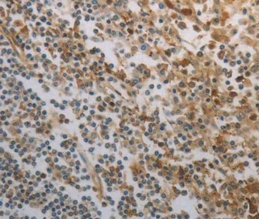 Anti-Human/Mouse/Rat INHA Antibody