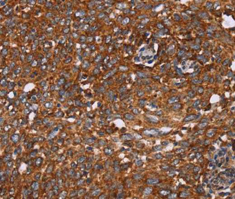 Anti-Human/Mouse CYP2W1 Antibody