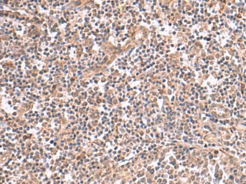 Immunohistochemistry of paraffin-embedded Human tonsil tissue using SLC12A7 Polyclonal Antibody at dilution of 1:50(×200)