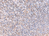 Immunohistochemistry of paraffin-embedded Human tonsil tissue using ITPKC Polyclonal Antibody at dilution of 1:40(×200)