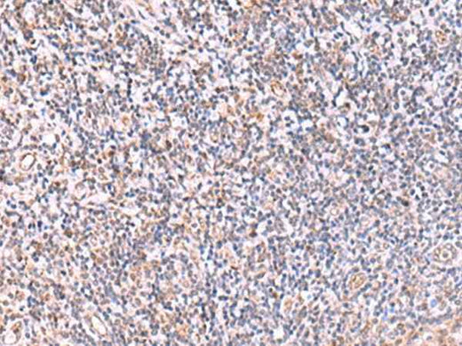 Anti-Human ITPKC Antibody