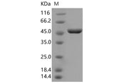 Recombinant SARS-CoV-2 N Protein (D3L,S235F)(His Tag) - ABMIUM