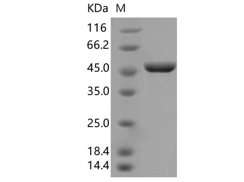 Recombinant SARS-CoV-2 N Protein (D3L,S235F)(His Tag) - ABMIUM