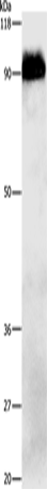 Anti-Human/Mouse/Rat APP Antibody - ABMIUM